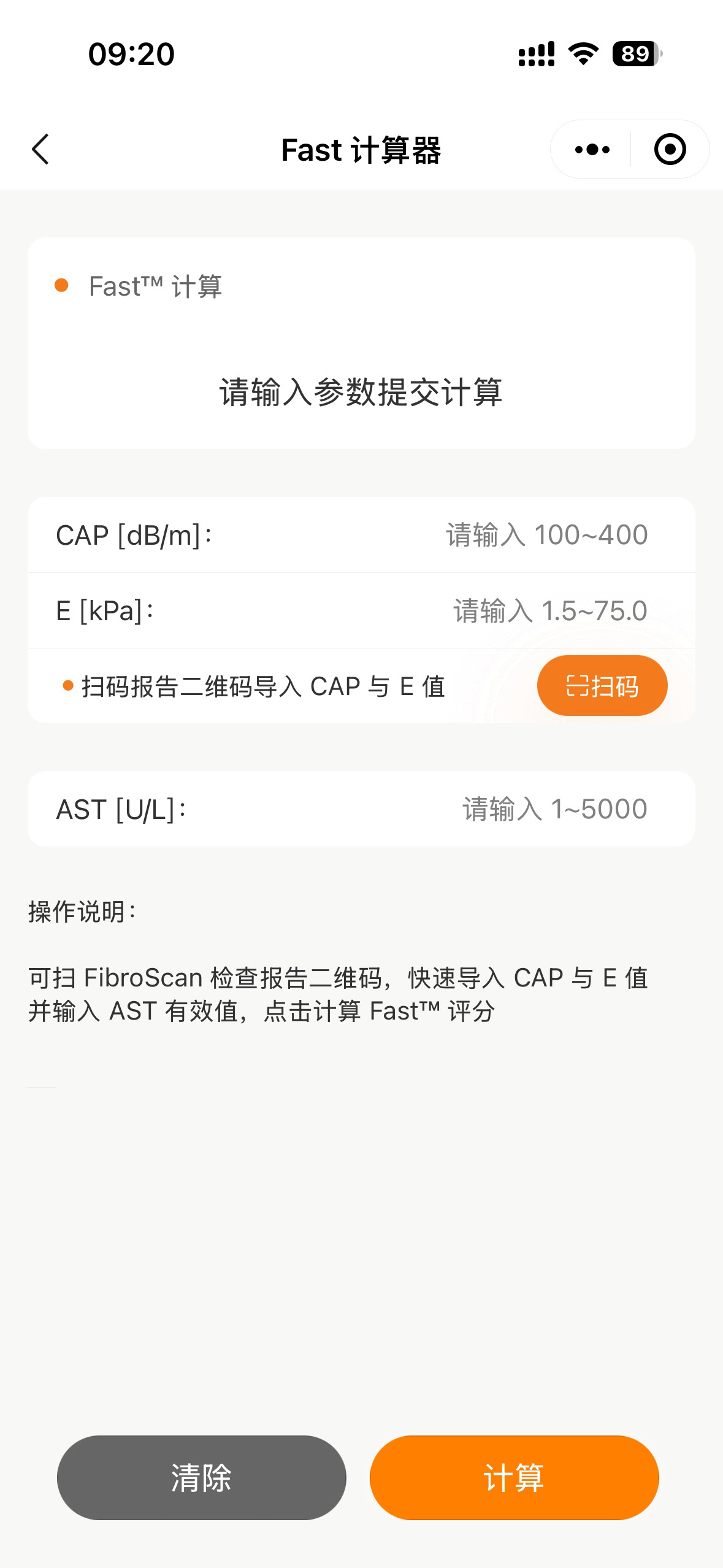 我的FibroScan评分 