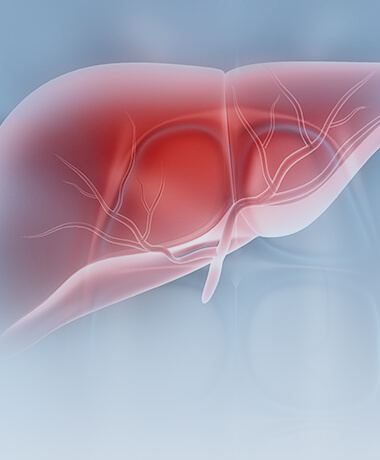肝癌高风险人群解决方案